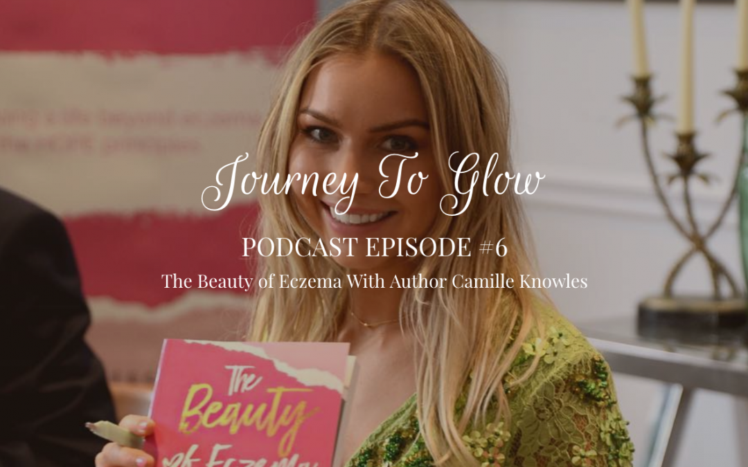 JTG #6 The Beauty of Eczema With Author Camille Knowles
